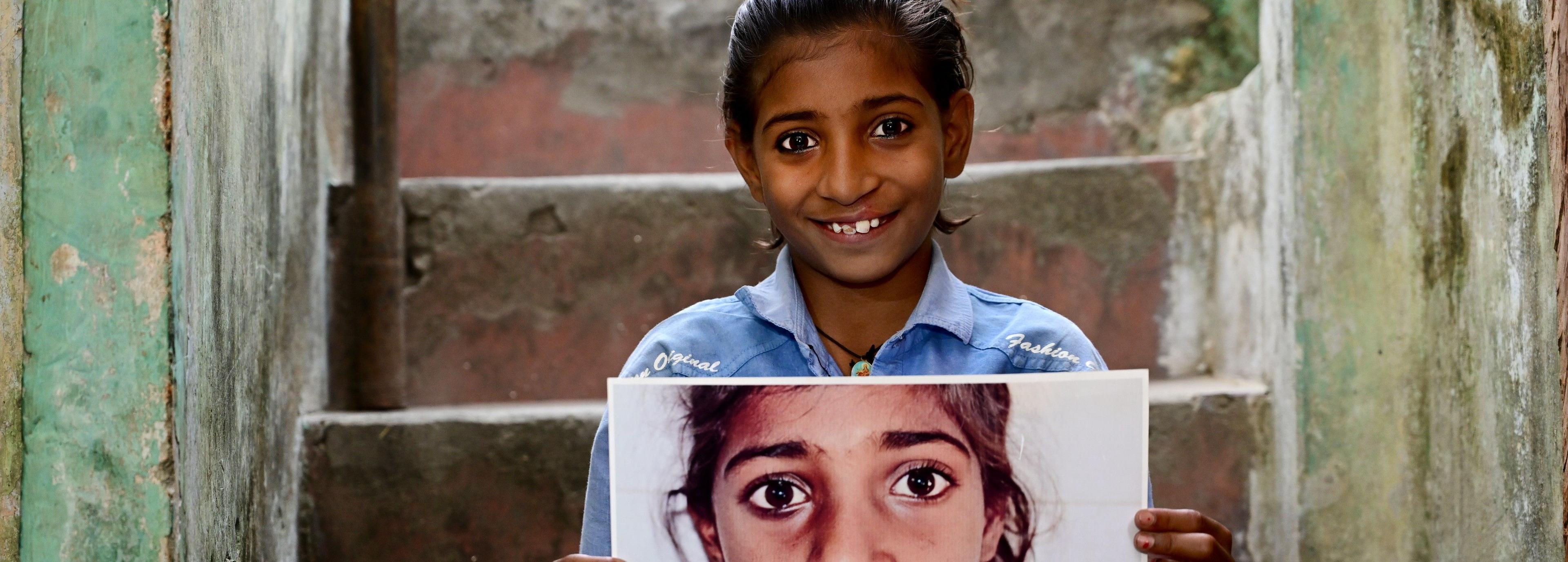 स्माइल ट्रेन - मुस्कान की भेंट